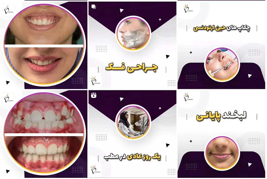 دکتر جهان بین از بهترین دکتر ارتودنسی در مشهد است