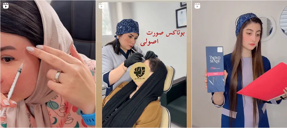 بوتاکس در بحنورد در کلینیک دکتر کاظمی کاملا قابل اجرا است