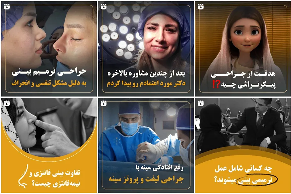 پروتز باسن در مشهد تسط دکتر معتمدی فر کاملا قابل انجام است