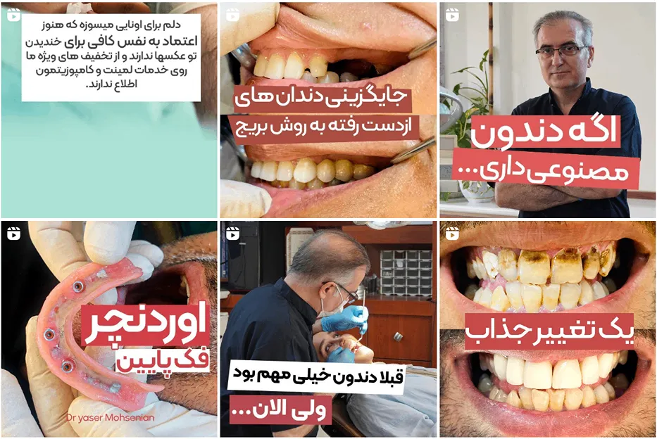 کامپوزیت در مشهد توسط دکتر محسنیان قابل انجام است