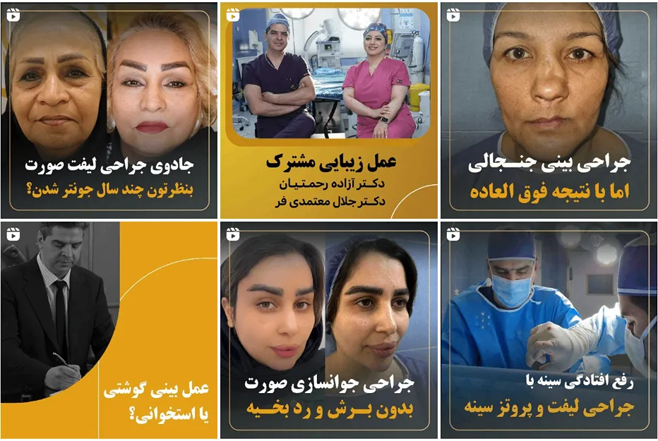 ابدومینوپلاستی در مشهد توسط دکتر معتمدی فر کاملا قابل اجرا است