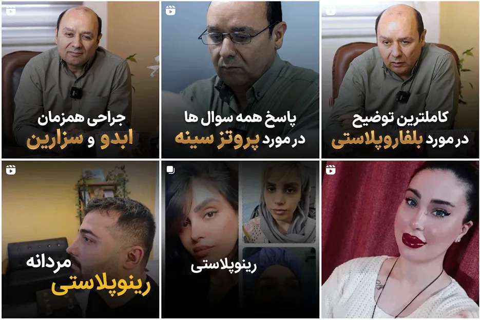 لیفت سینه در مشهد توسط دکتر نقدی قابل انجام است