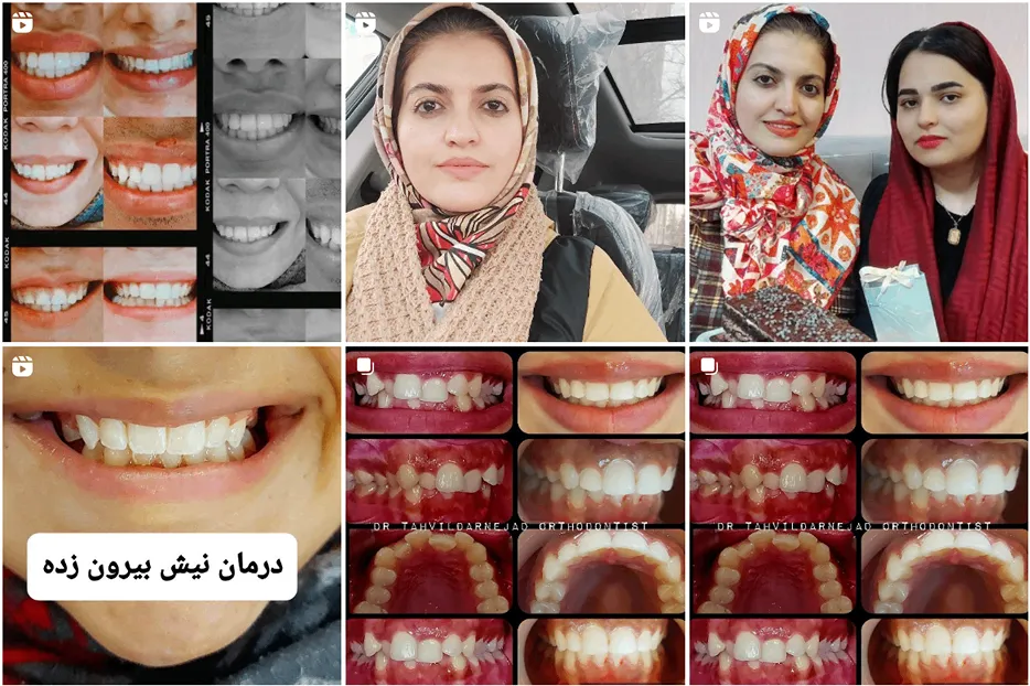 ارتودنسی در مشهد توسط دکتر تحویلدار نژاد کاملا قابل انجام است