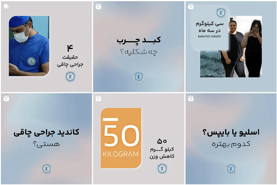 عمل لیپوساکشن در مشهد توسط دکتر نوروزی قال انجام است