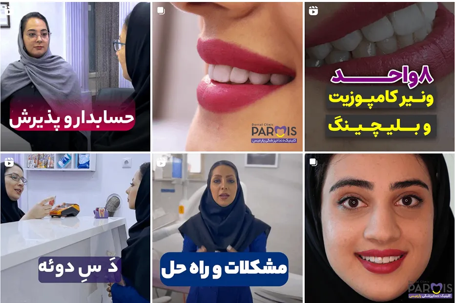 کلینیک دندان پزشکی پارامیس از بهترین کامپوزیت مشهد است