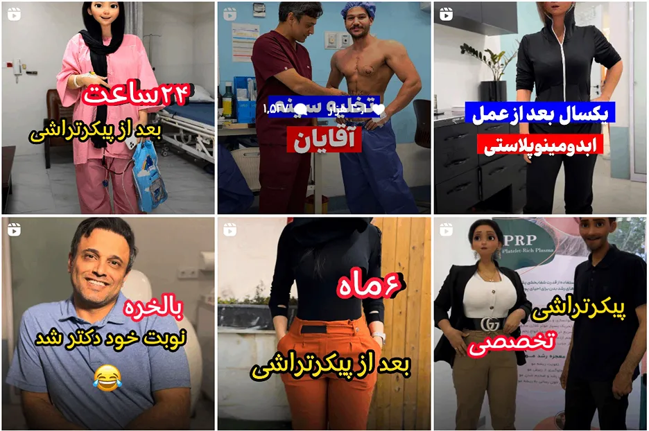 ماموپلاستی در مشهد توسط دکتر قربانزاده قابل انجام است