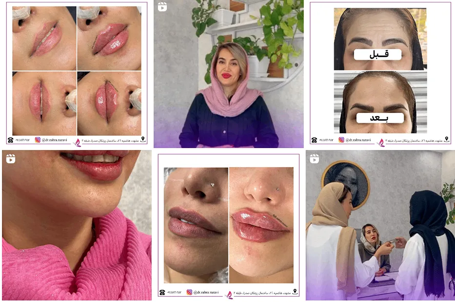 تصویر یکی از بهترین کلینیک لیفت با نخ در مشهد را مشاهده میفرمایید.