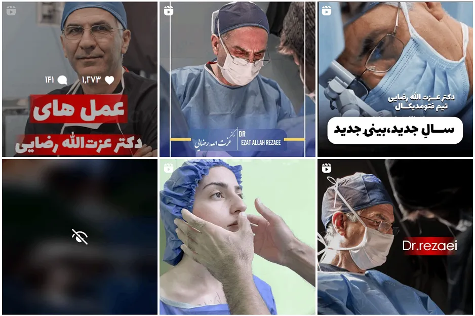 ابدومینوپلاستی در مشهد توسط دکتر رضایی کاملا قابل انجام است