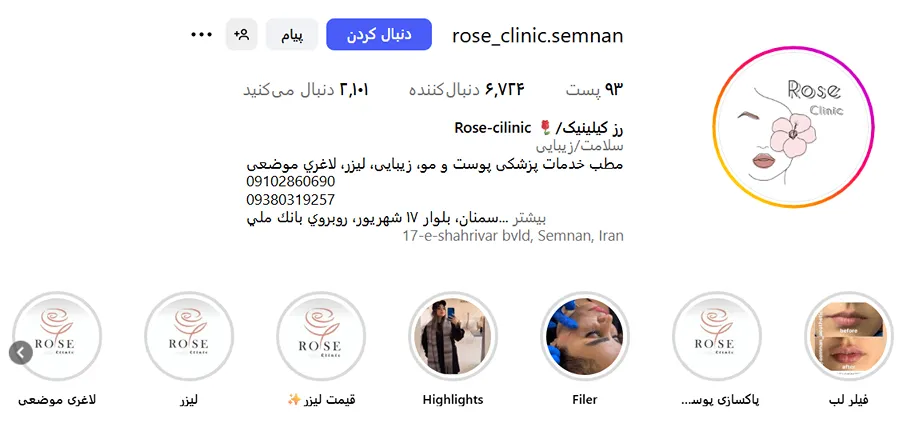 بوتاکس سمنان توسط کلینیک رز کاملا قابل انجام است