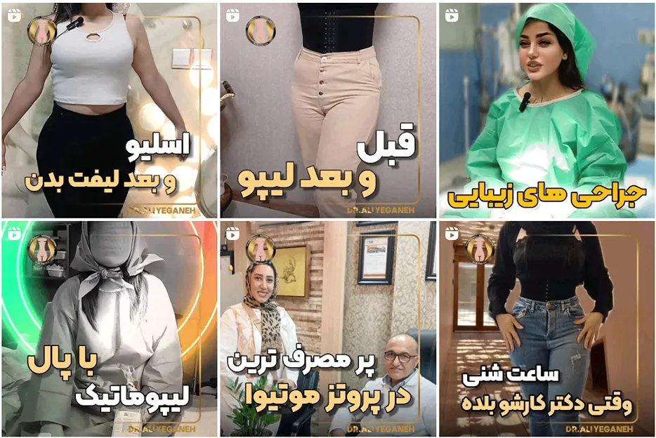 لیپوساکشن در مشهد توسط دکتر یگانه قابل انجام است
