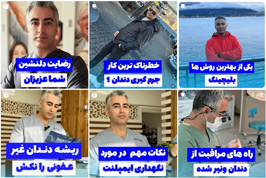 دکتر آزادگان از بهترین دکتر بلیچینگ دندان در مشهد است