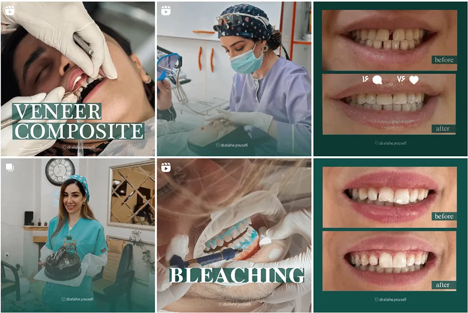 عصب کشی دندان در مشهد توسط دکتر یوسفی کاملا قابل انجام است