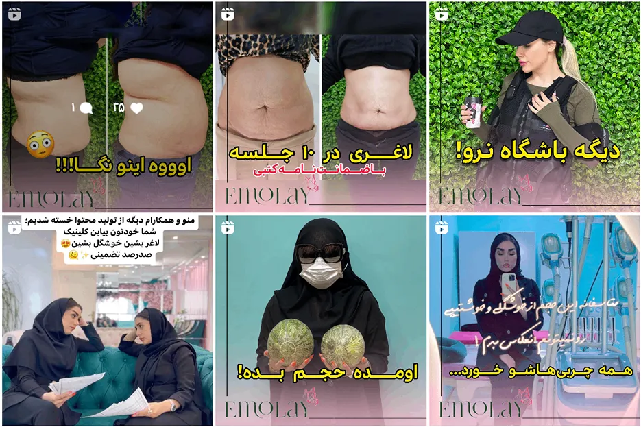 لاغری موضعی در مشهد در کلینیک امولای قابل انجام است