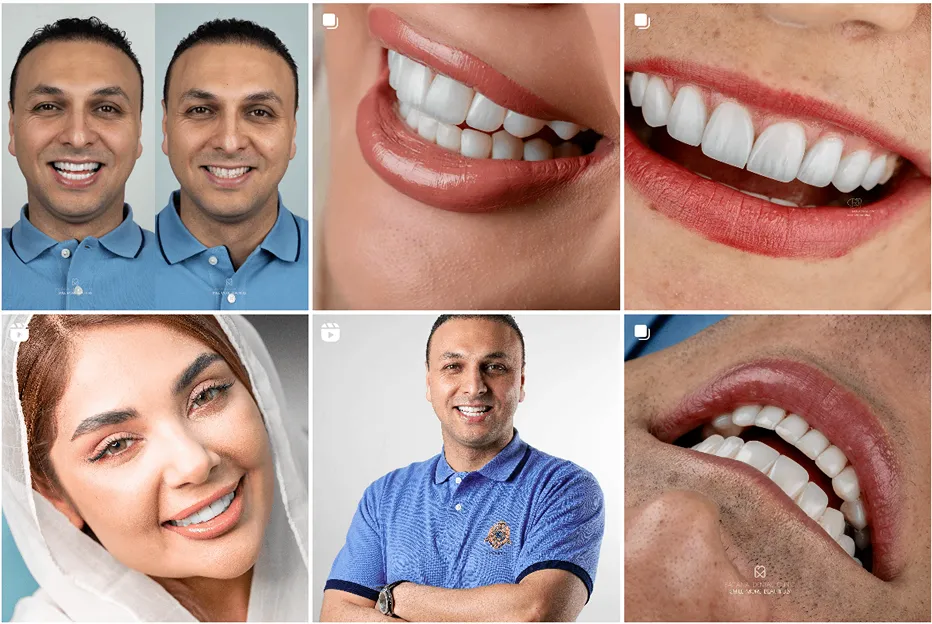 دندان پزشک زیبایی مشهد در کلینیک بارانا قابل انجام است