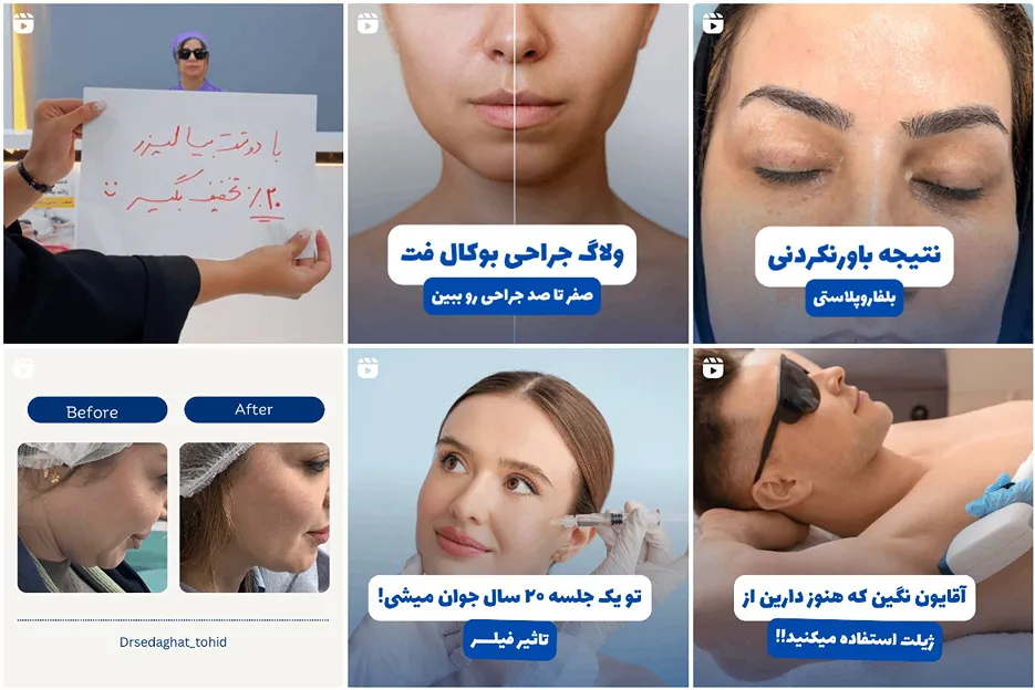 نمونه کار بهترین دکتر بوکال فت در مشهد را میتوانید مشاهده بفرمایید.