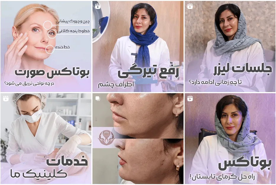 تصویر یکی از بهترین کلینیک لیفت با نخ در مشهد را مشاهده میفرمایید.