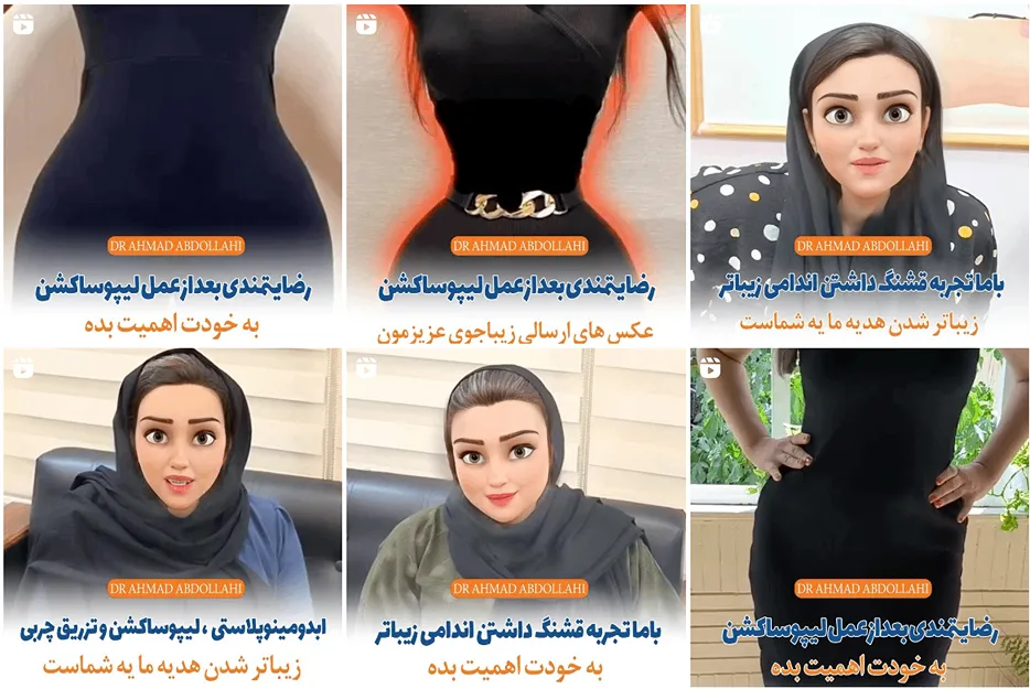 عمل کوچک کردن سینه در مشهد توسط دکتر عبدالهی قابل انجام است