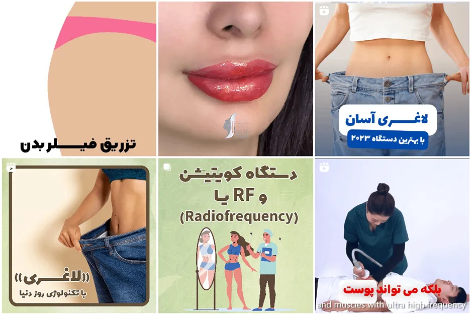 لاغری موضعی در مشهد توسط دکتر صداقت قابل انجام است