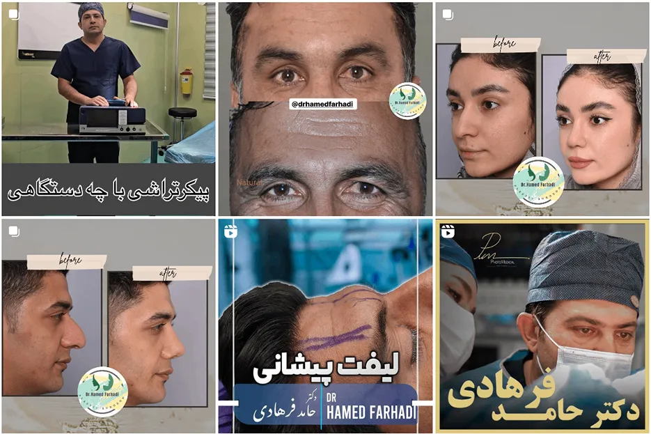 لیپوماتیک مشهد توسط دکتر فرهادی قابل انجام است