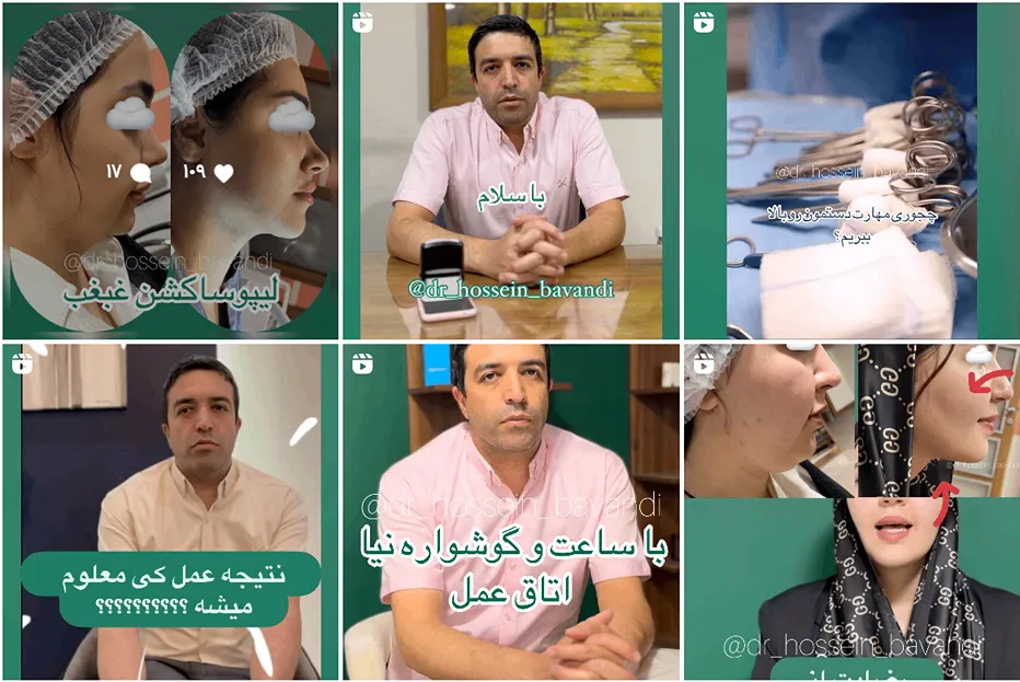 پیکرتراشی در مشهد توسط دکتر باوندی قابل انجام است