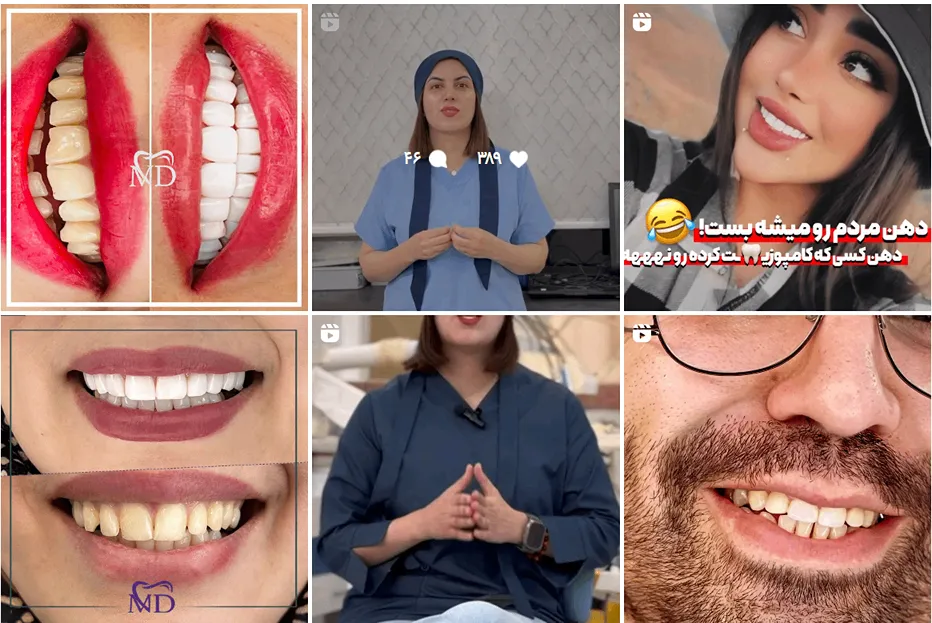 عصب کشی دندان در مشهد توسط دکتر دائمی کاملا قابل انجام است