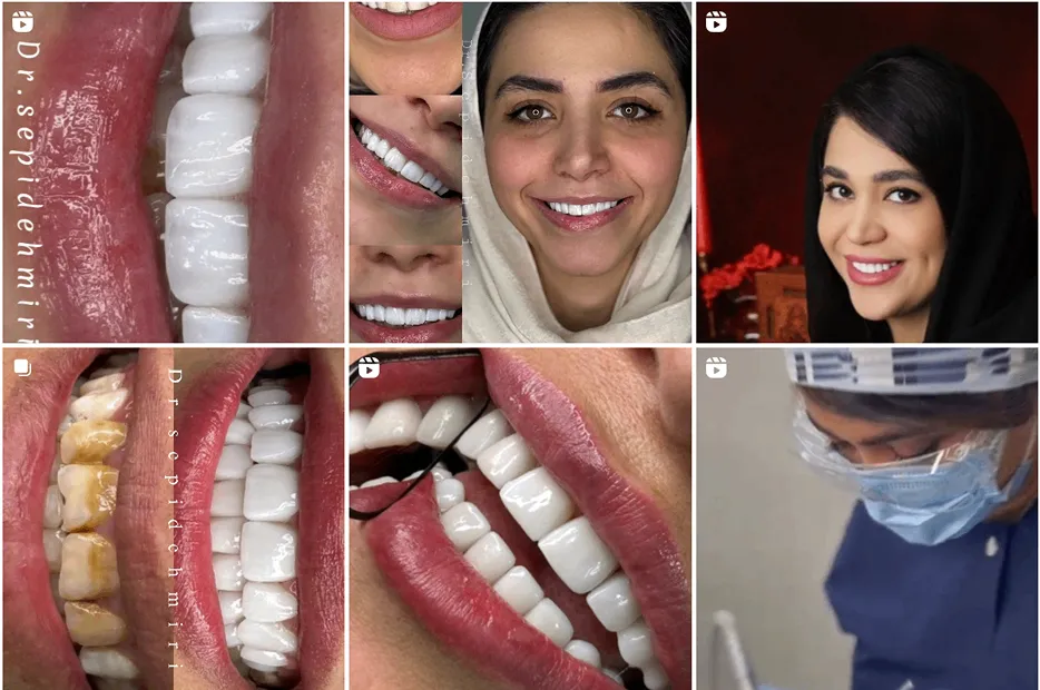 پروتز دندان در مشهد توسط دکتر میری کاملا قابل انجام است