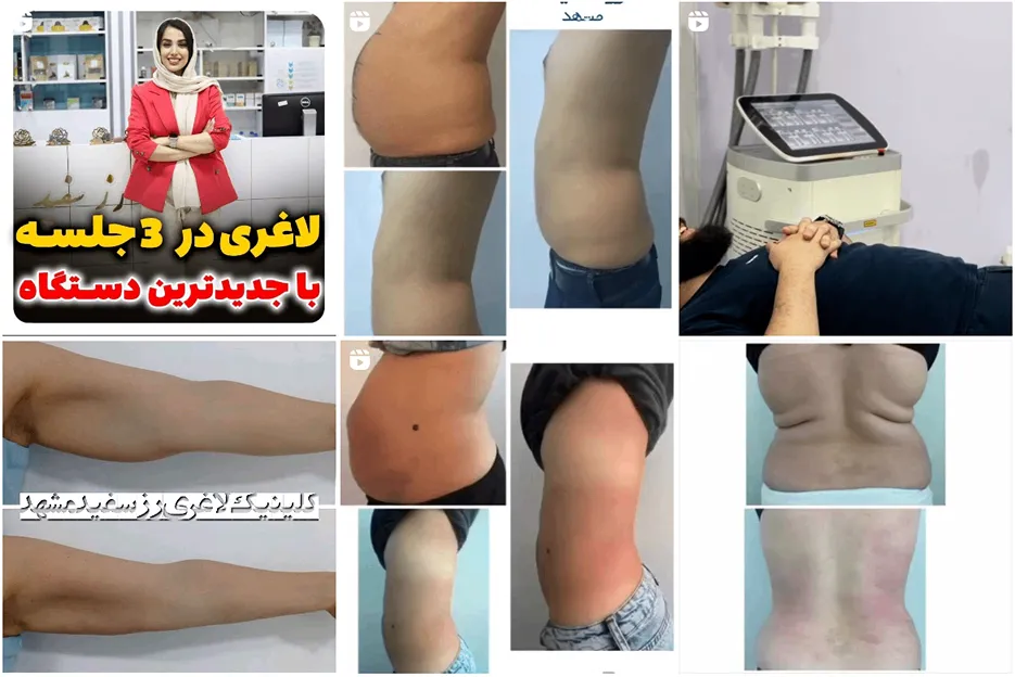 تصویر یکی از کلینیک لاغری در مشهد را مشاهده میفرمایید.
