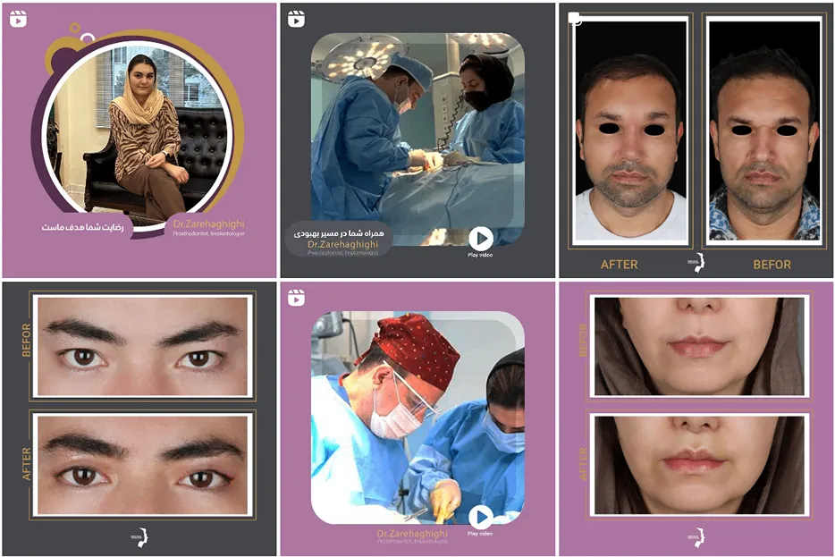 بوکال فت در مشهد توسط دکتر حقیقی کاملا قابل انجام است