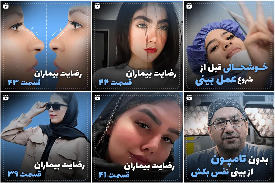 دکتر زرین قلم از بهترین دکتر عمل ترمیم بینی در مشهد است