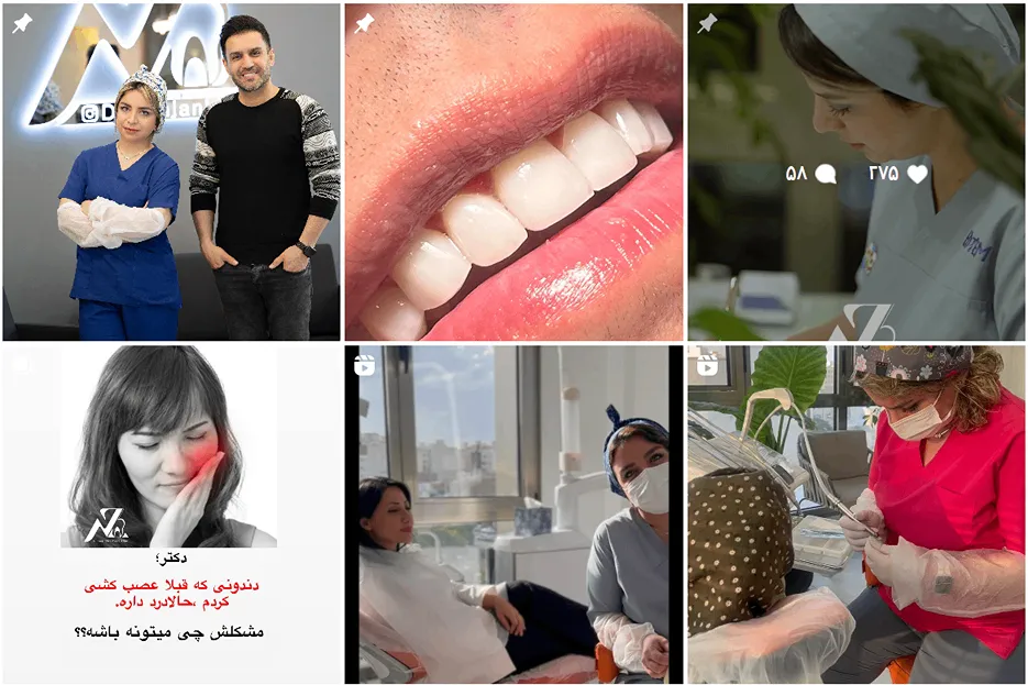 دندان پزشک زیبایی در مشهد توسط دکتر زنجان خواه قابل انجام است