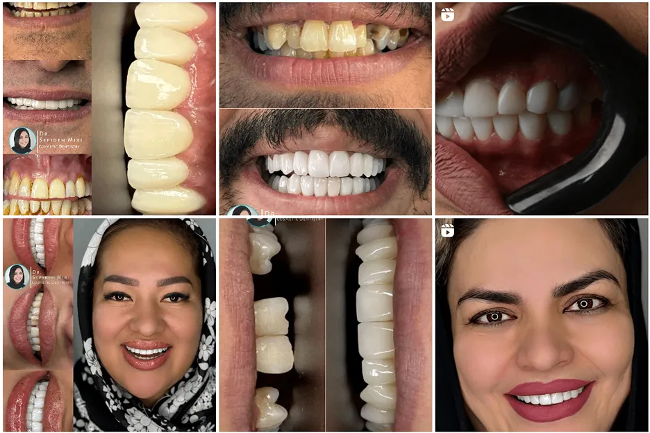 عصب کشی دندان در مشهد توسط دکتر میری کاملا قابل انجام است