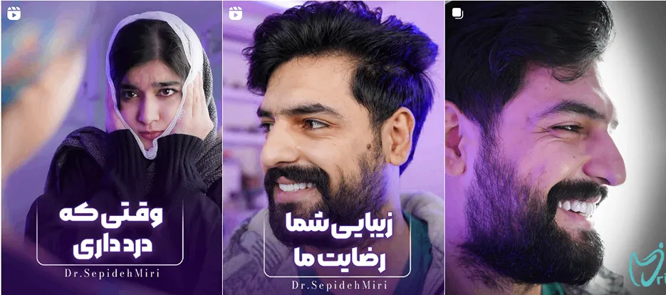 نمونه کار یکی دیگر از بهترین دندان پزشک زیبایی در مشهد را میتوانید در این قسمت مشاهده بفرمایید.