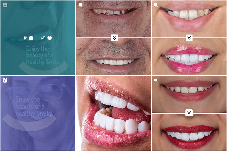 دندان پزشک زیبایی در مشهد توسط دکتر شاهرخی قابل انجام است