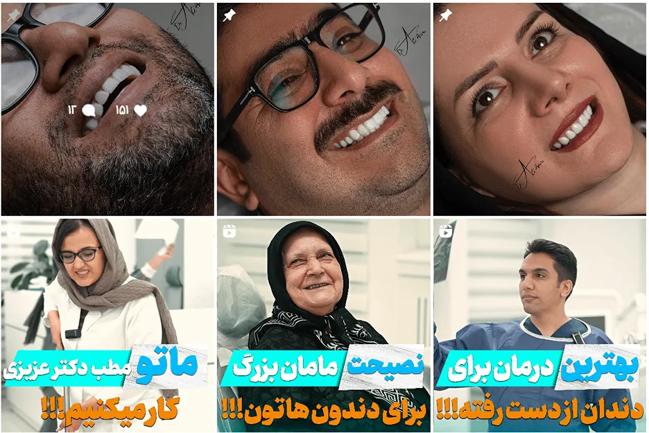 بلیچینگ دندان در مشهد توسط دکتر عزیزی قابل انجام است