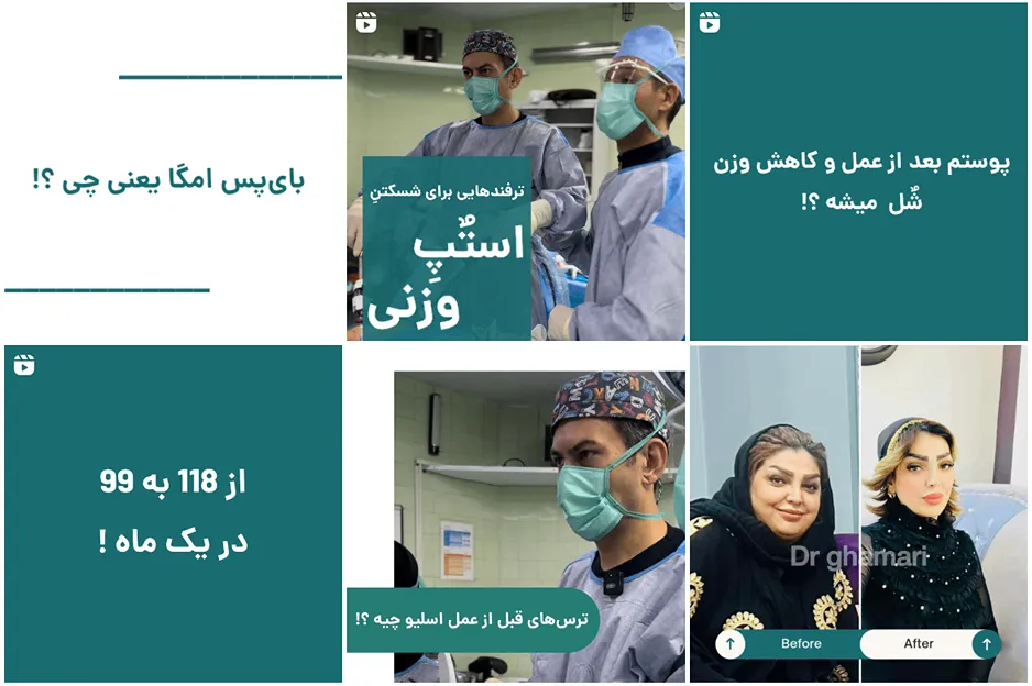 دکتر قمری از بهرتین دکتر عمل بای پس معده د مشهد است