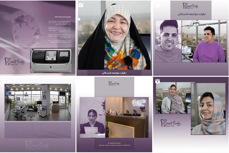 پروتز دندان مشهد توسط کلینیک لبخند هوشمند کاملا قابل انجام است