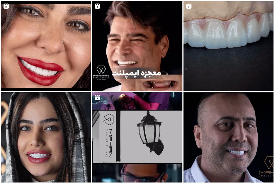 دندان پزشک زیبایی در مشهد توسط کلینیک ماهان قابل انجام است