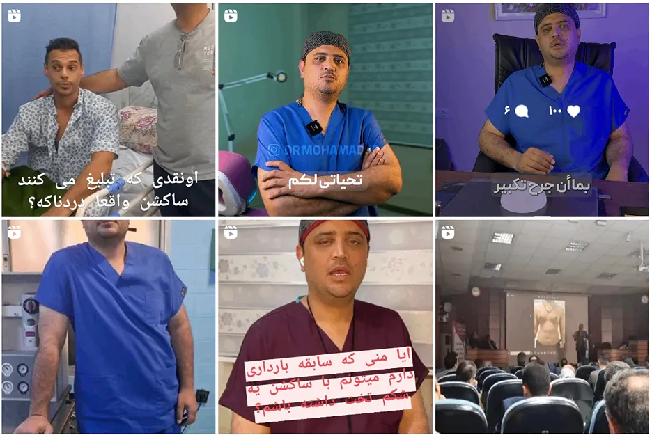 عمل پیکرتراشی در مشهد به عوامل کاملا مختلفی وابسته است