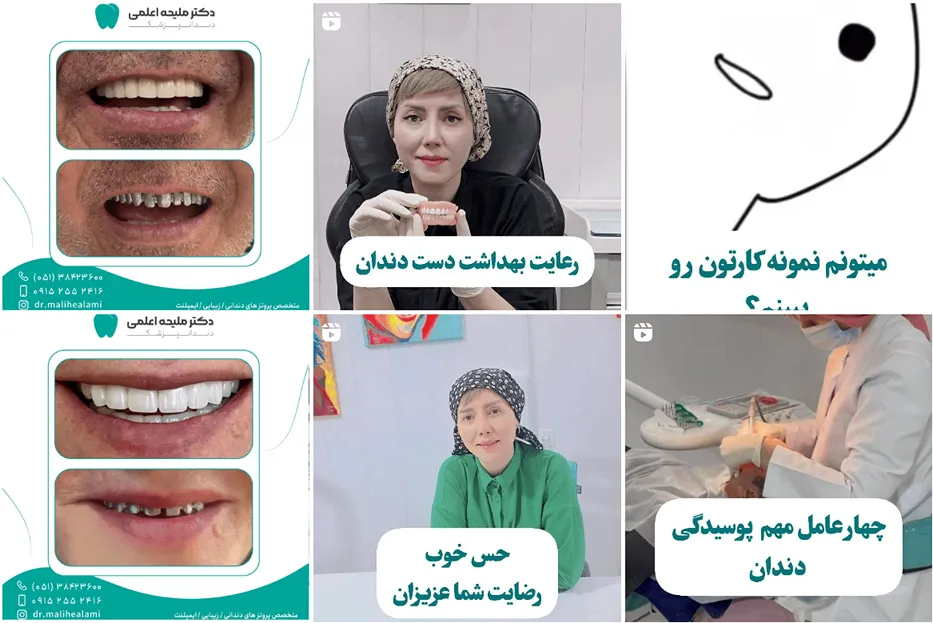 پروتز دندان در مشهد توسط دکتر اعلمی کاملا قابل انجام است