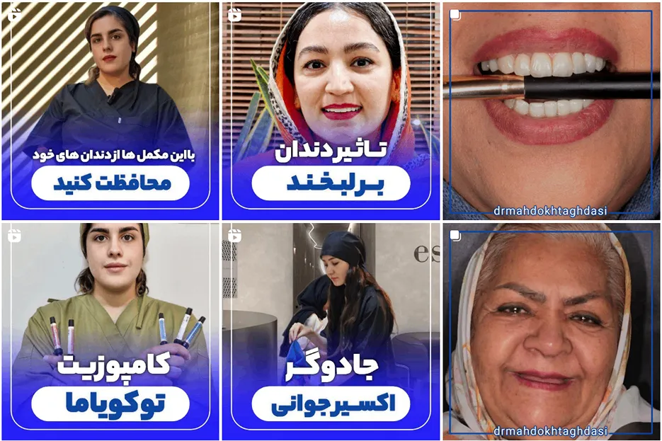 پروتز دندان در مشهد توسط دکتر اقدسی کاملا قابل انجام است