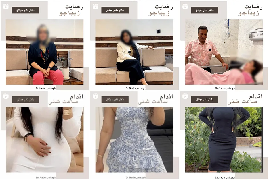 هزینه پیکرتراشی در مشهد به عوامل کاملا مختلفی وابسته است