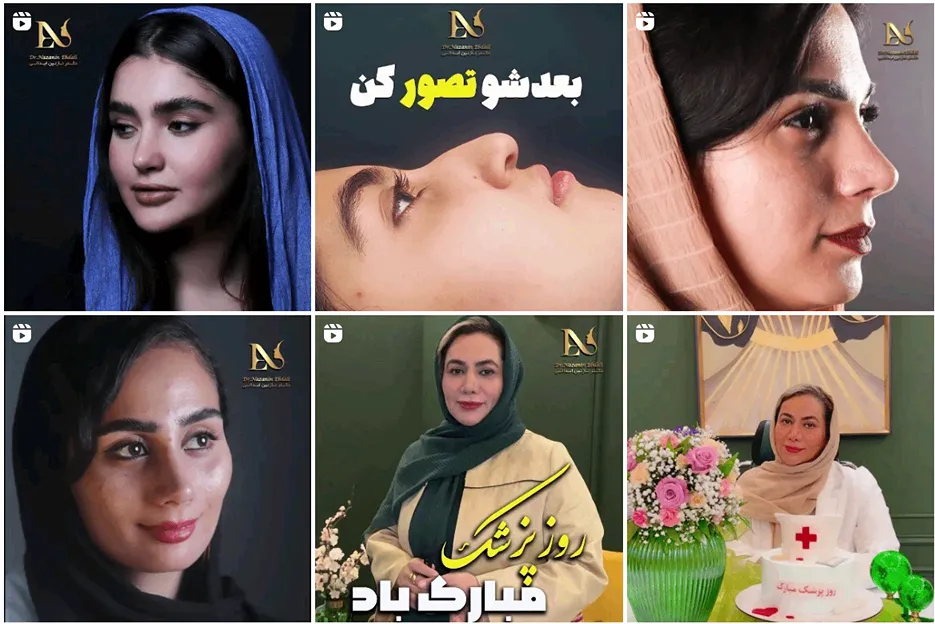 جراح بینی ترمیمی در مشهد توسط دکتر ابدالی کاملا قابل انجام است