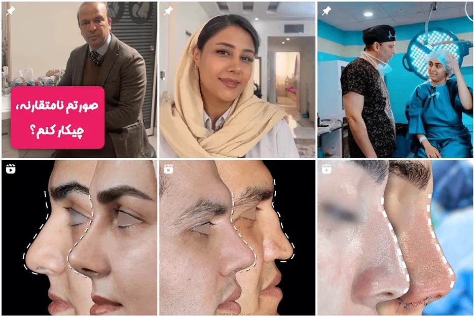 جراحی بینی گوشتی در مشهد توسط دکتر صدر قابل انجام است