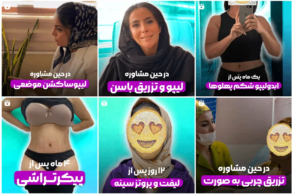 عمل لیپوماتیک در مشهد توسط دکتر ناویافر قابل انجام است