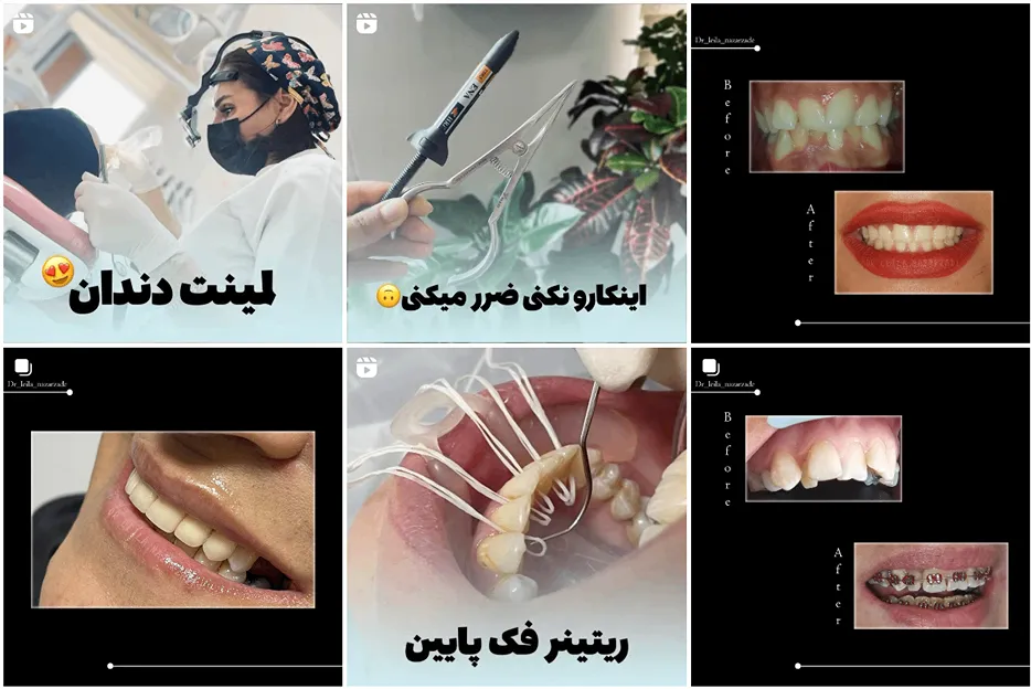 دندان پزشک زیبایی مشهد توسط دکتر نظرزاده قابل انجام است