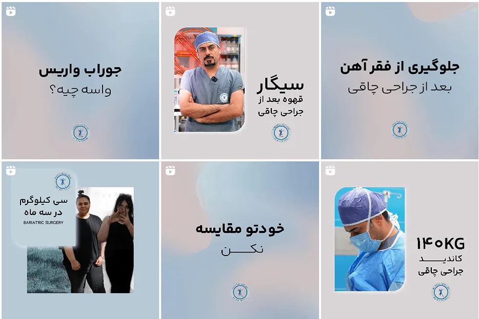 نمونه کار یکی از بهترین دکتر جراحی چاقی در مشهد را مشاهده میفرمایید.