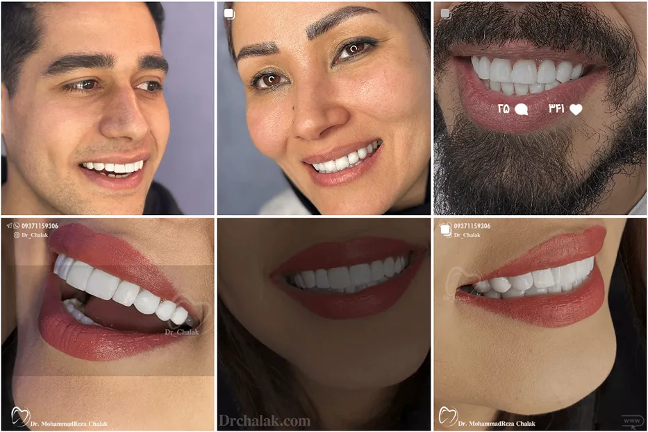 دندان پزشک زیبایی مشهد توسط دکتر چالاک قابل انجام است