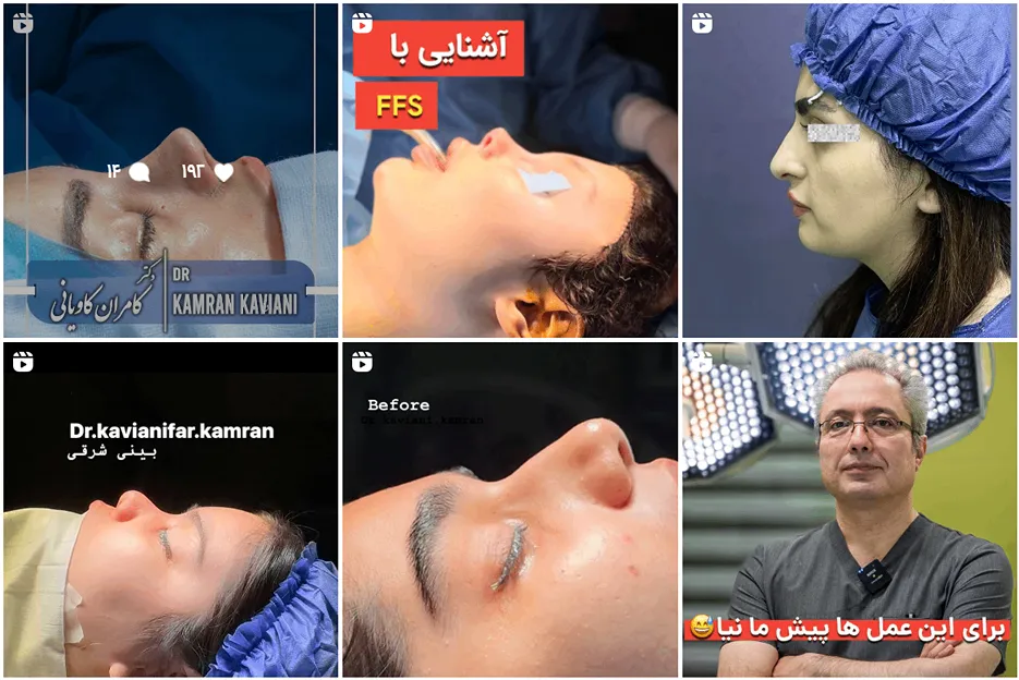 جراح بینی ترمیمی در مشهد توسط دکتر سرابی قابل انجام است