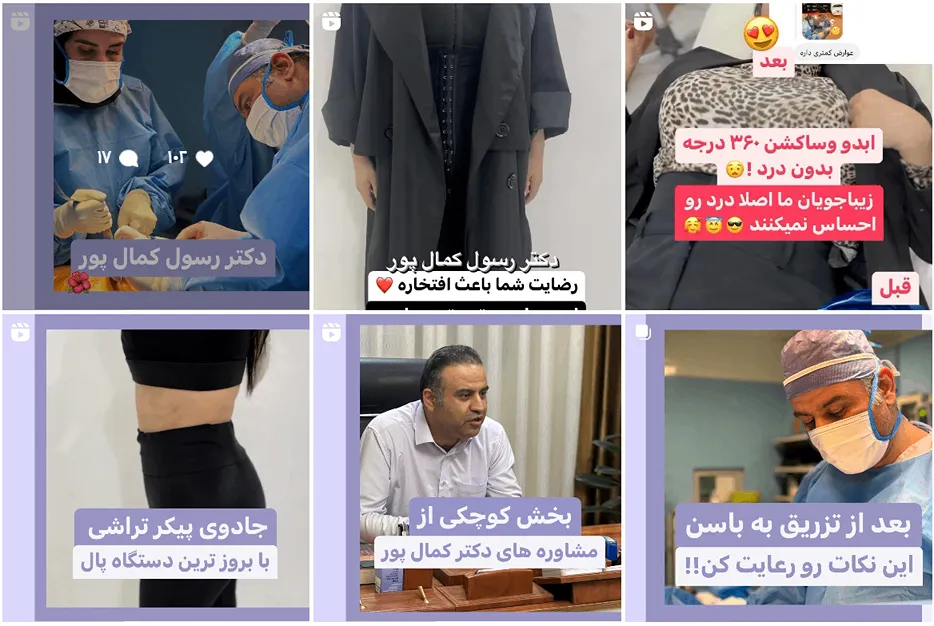 دکتر کمالپور از بهترین دکتر پیکرتراشی در مشهد است