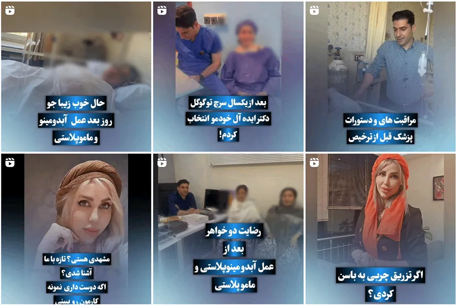 هزینه پیکرتراشی در مشهد به عوامل کاملا مختلفی وابسته است